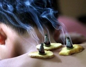 艾灸的正確方法步驟_正確的艾灸方法_艾灸治療肛瘺方法