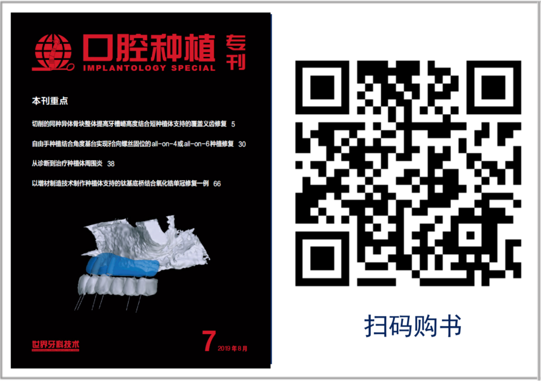 

本文：口腔種植修復領域的重要組成部分(圖)