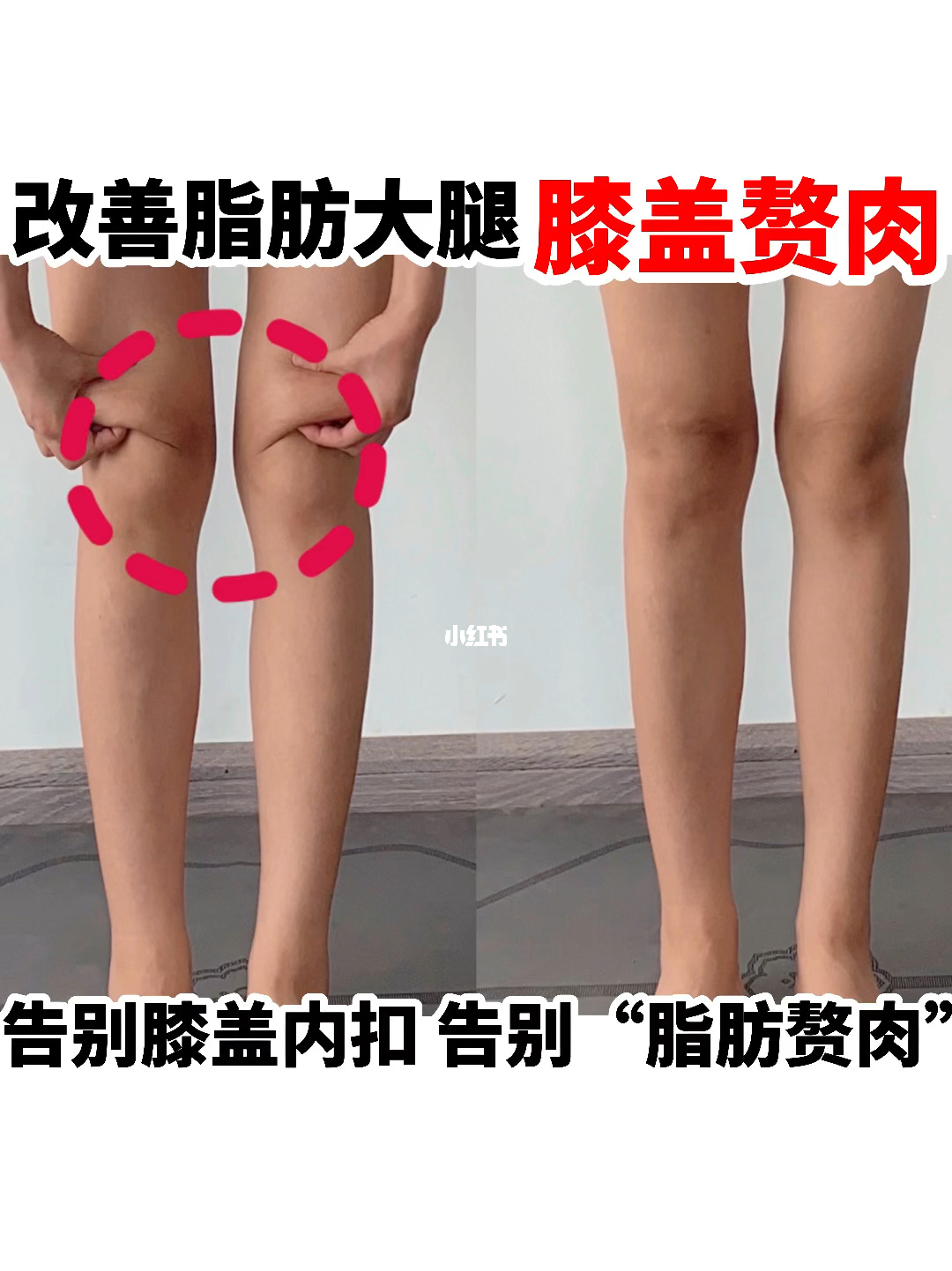 學生怎么快速瘦肌肉腿_不吃藥快速瘦小腿的方法_怎樣的運動能快速瘦大象腿