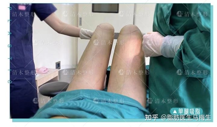 怎樣的運動能快速瘦大象腿_不吃藥快速瘦小腿的方法_學生怎么快速瘦肌肉腿