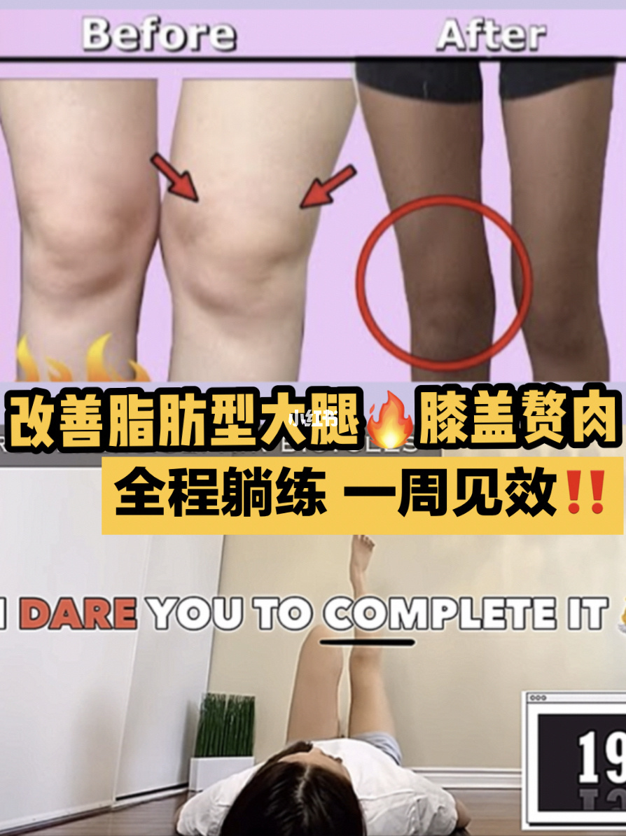 不吃藥快速瘦小腿的方法_怎樣的運動能快速瘦大象腿_學生怎么快速瘦肌肉腿