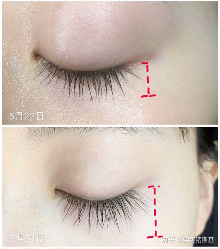 眼睫毛變長的天然方法_父母睫毛短,小孩睫毛長_怎樣睫毛變密變長方法