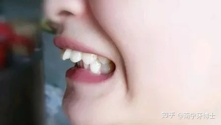 打坐呼吸意守方法_打坐呼吸方法_打坐呼吸念佛