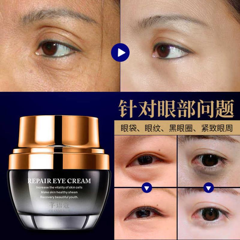 熬夜有黑眼圈怎么去除_去黑眼圈最好方法_黑眼圈去除方法
