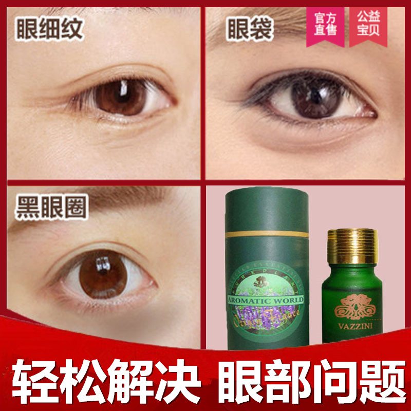 去黑眼圈最好方法_黑眼圈去除方法_熬夜有黑眼圈怎么去除