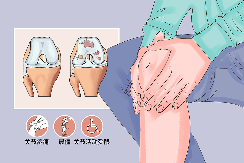治療濕疹的最佳方法_治療內(nèi)風濕最好的方法_治療風濕的最佳方法
