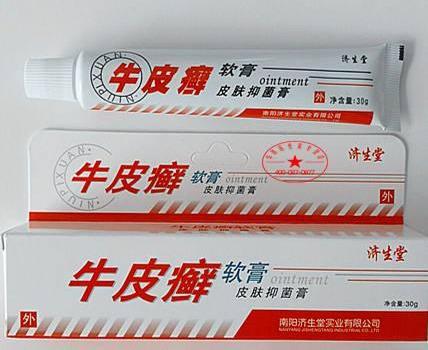 上海治療牛皮癬_牛皮癬治療_牛皮癬的治療方法