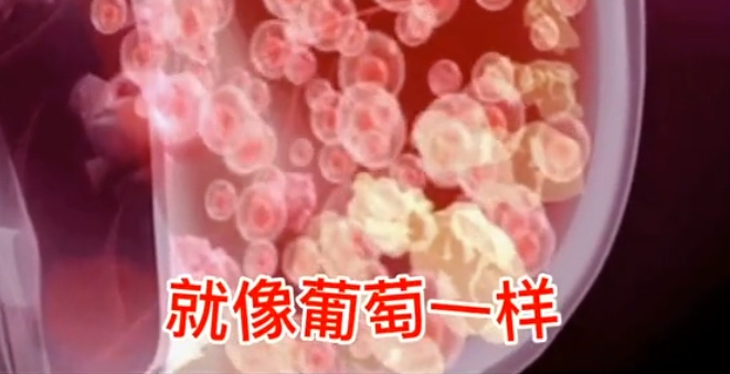 初中生胸部按摩圖方法_按摩胸部方法圖解_下奶胸部按摩方法視頻