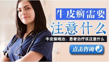 生活中要注意牛皮癬治療的方法也是很多的，有哪些