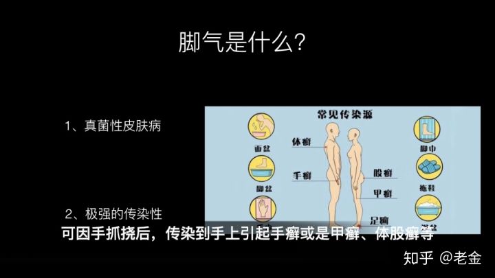 治療腳氣最快的方法_腳氣的治療方法_治療腳氣的最好方法