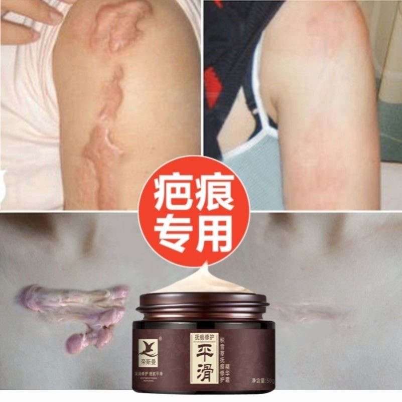 凹陷性疤痕能不能看呢嗎？南寧皮膚病醫(yī)院怎么樣