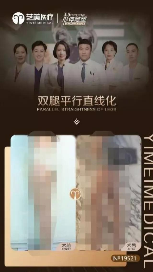 想變成“漫畫腿”，不料卻摔傷眼睛“本想靠著”