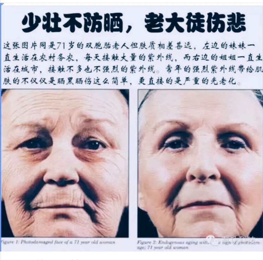 經(jīng)常大笑的人，容易長皺紋？是真的嗎？