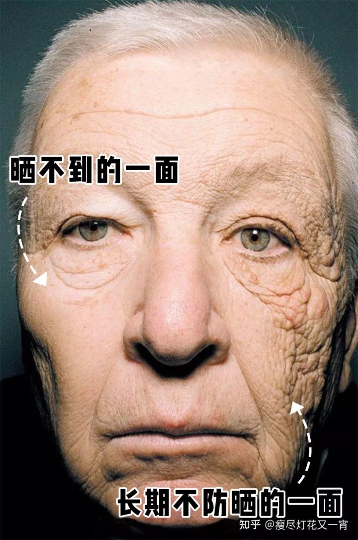 去眼皺紋最好的方法_去皺紋最好方法_去皺紋最好方法
