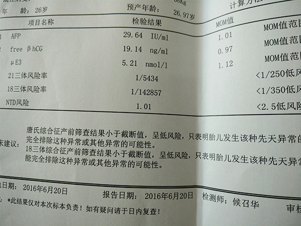 唐篩不能判斷性別