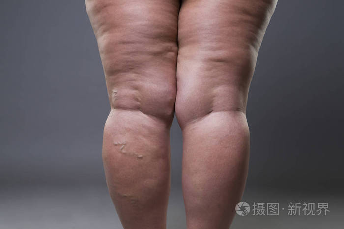 臀部減肥最快方法_臀部減肥最快的方法_臀部大怎么減肥