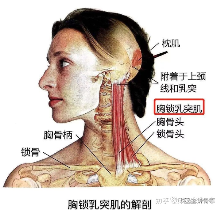 嬰兒斜頸的治療方法_嬰兒斜頸_嬰兒斜頸照片