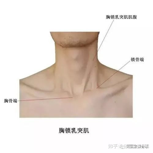 嬰兒斜頸的治療方法_嬰兒斜頸_嬰兒斜頸照片