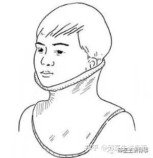 嬰兒斜頸照片_嬰兒斜頸的治療方法_嬰兒斜頸