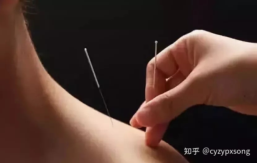 美容院刮痧排毒_刮痧排毒方法_排毒刮痧對臉有壞處嗎？