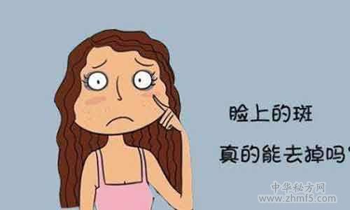 雀斑怎么去除?中華秘方網小編教你去除雀斑的小偏方