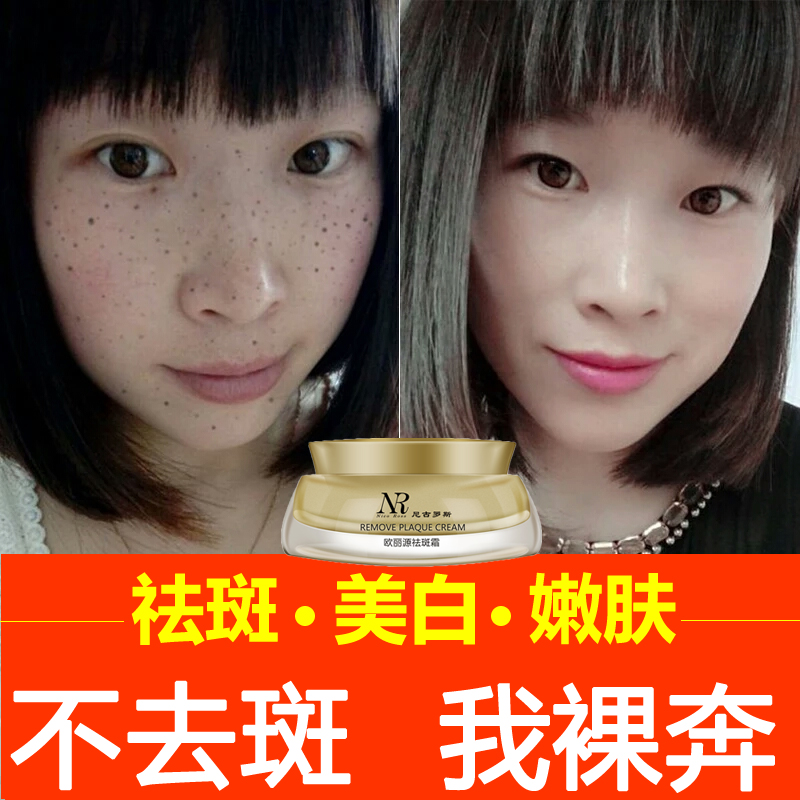 去雀斑方法_有效去雀斑民間方法_去雀斑最好最快的方法