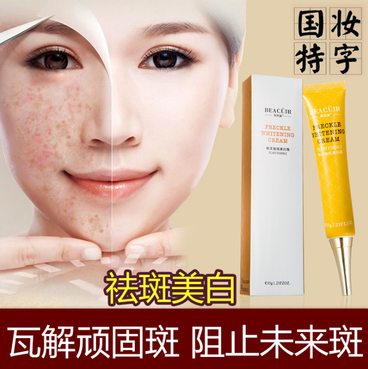 去雀斑方法_去雀斑最好最快的方法_有效去雀斑民間方法