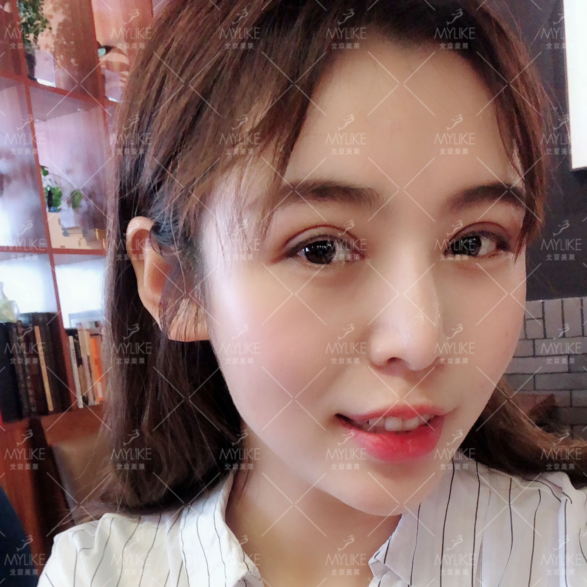 眼部除皺的整形_會計知識技能競賽競賽理論142題_眼部整形知識競賽題