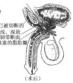 男人增大增粗的各種方法，你知道嗎？！！
