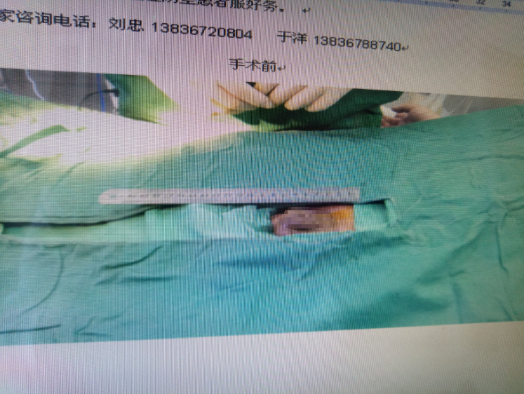 陰莖增大增粗鍛煉方法_美國dld增大鍛煉方法_陰莖上涂抹增大膏能增大嗎