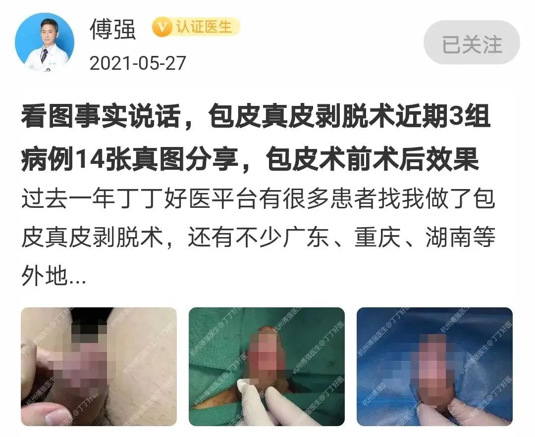 陰莖增大增粗鍛煉方法_美國dld增大鍛煉方法_陰莖上涂抹增大膏能增大嗎
