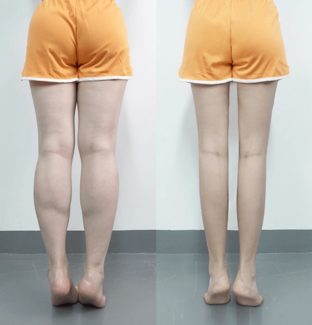 怎樣瘦大象腿最快方法視頻_怎樣瘦大象腿 學生瘦腿方法讓_怎樣瘦大象腿 學生瘦腿方法讓