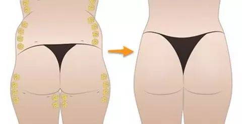 怎么樣瘦臀部和大腿_瘦大腿臀部的運動方法_怎樣可以瘦臀部以及大腿