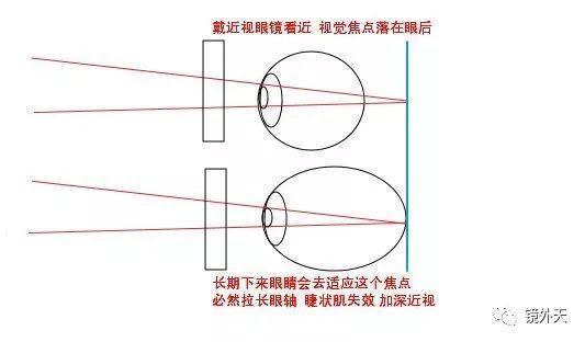 卵磷脂絡(luò)合碘片 飛蚊_飛蚊癥的治療方法_治療幻聽癥八種方法