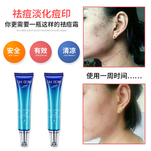 清除痘印的方法_怎樣能清除痘印_消除痘印最快的方法