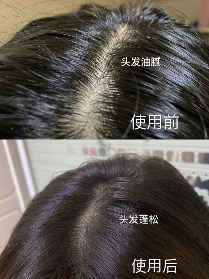 2.防止脫發最有效的方法線發量減少、頭發干枯分叉