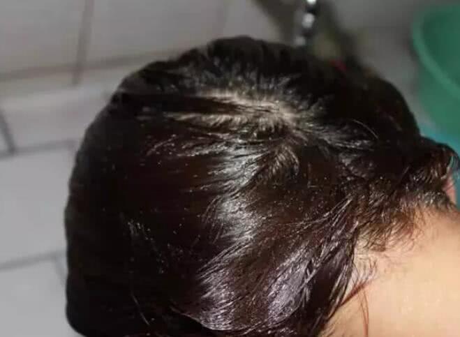 失眠脫發(fā)的治療方法_脫發(fā)治療的最佳方法_防脫發(fā)的最佳方法