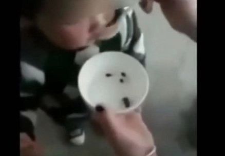能量腦氧霜 活腦因子_肯德基活蟲女子肯德基吃雞翅吃出數條活蟲_女子暴瘦20斤腦內取出27厘米活蟲