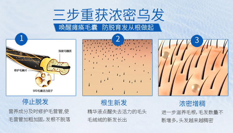 防脫發的最佳方法_脫發、白發轉黑特效方法_地基防潮的最佳方法
